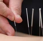 Kowall Chiropractic Centres Acupuncture Services